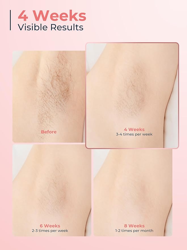 Beauris IPL Laser Hair Removal Device