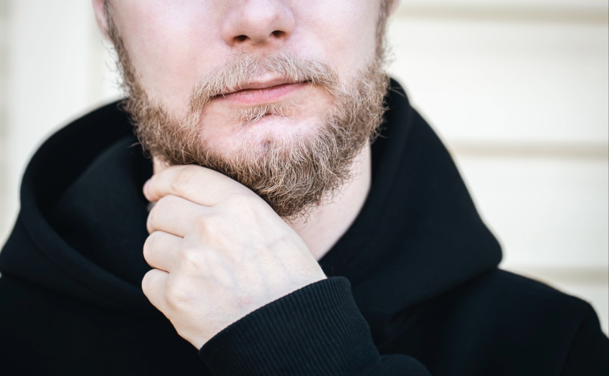 man with patchy beard on upper chin